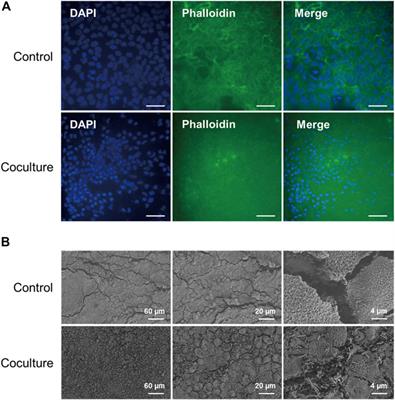 Investigation of metabolic crosstalk between host and pathogenic Clostridioides difficile via multiomics approaches